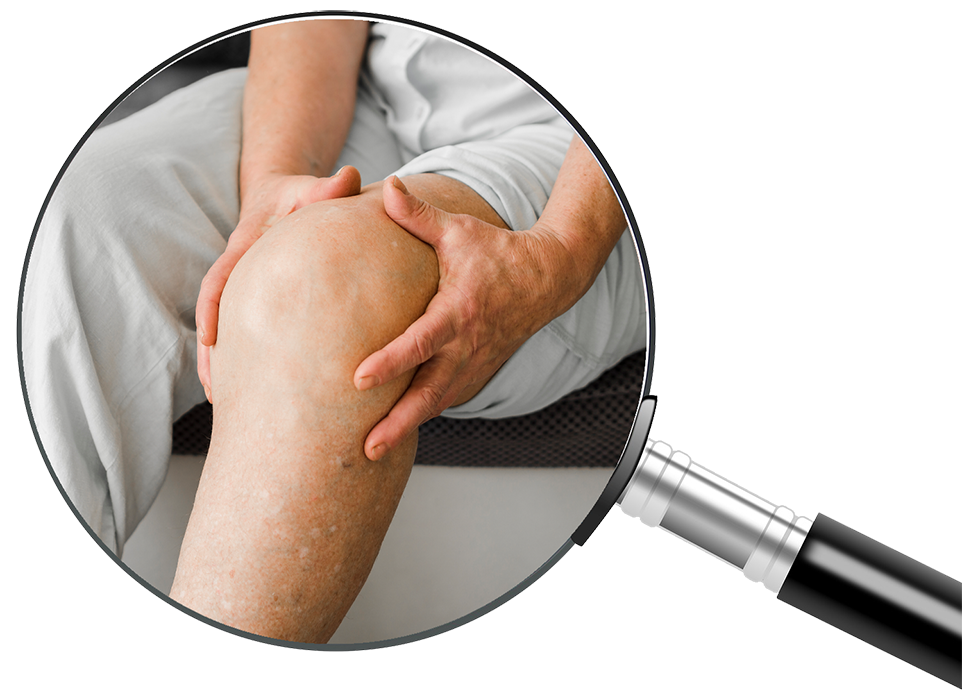 Rodilla_TNDR_Causas_Bilbao